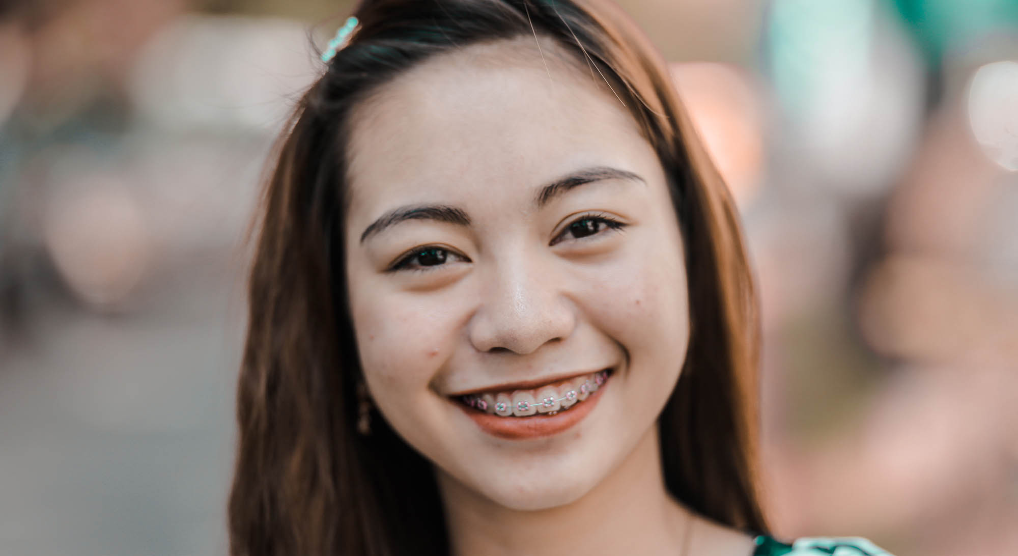 Girl wearing traditional metal braces